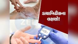 પગમાં આવું જોવા મળે તો ચેતી જજો...જાણો ડાયાબિટીસના આ 5 સંકેત વિશે