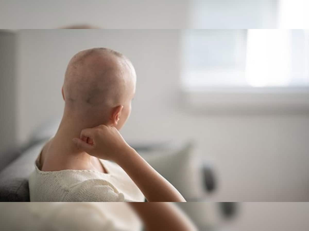 Chemotherapy Side Effects: કેન્સરની સારવાર દરમિયાન શા માટે ખરી જાય વાળ ? કેટલા સમય પછી ઉગે નવા વાળ?