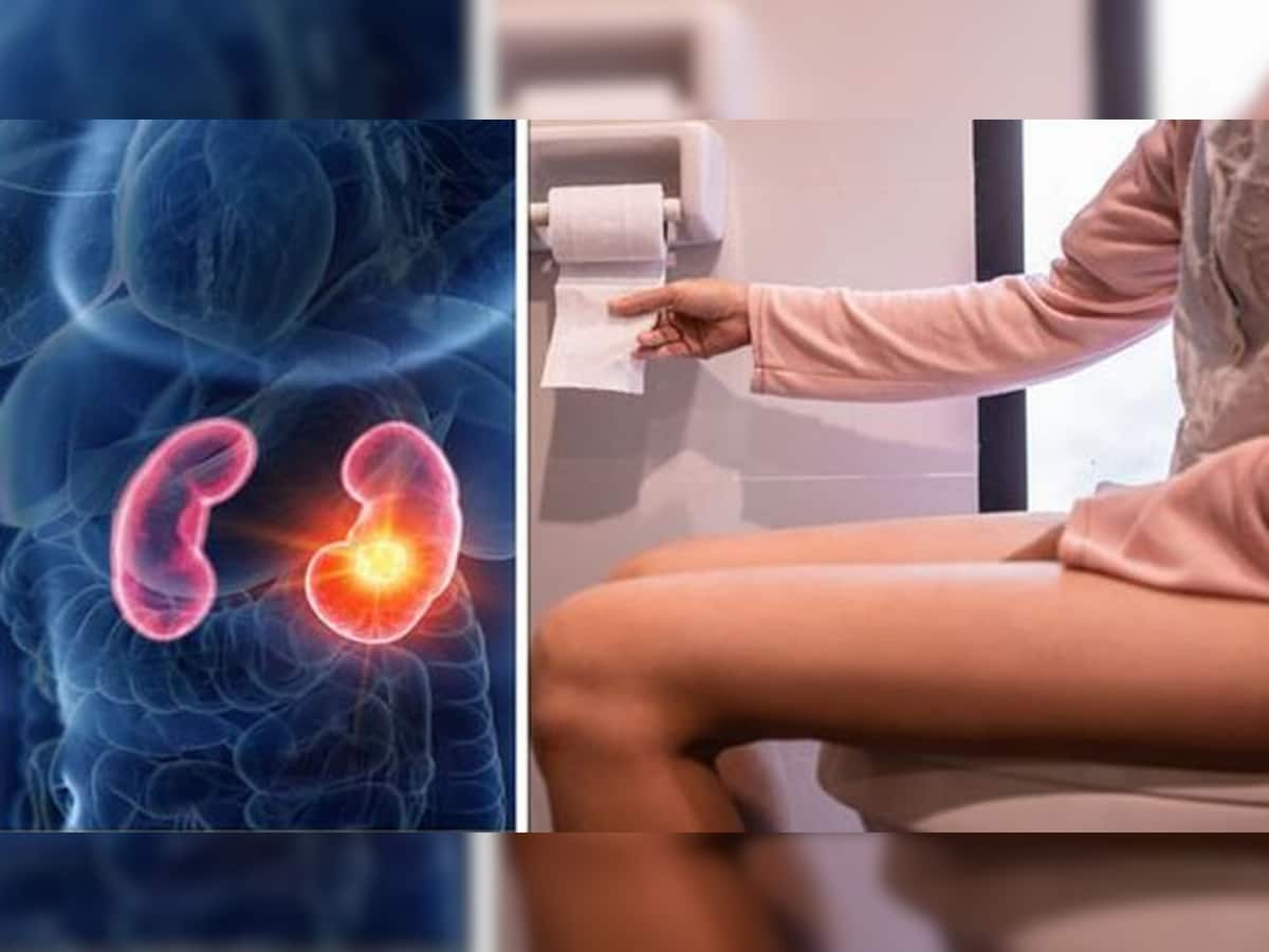 Kidney Damage Symptoms: પેશાબમાં દેખાવા લાગે છે આ લક્ષણ તો સમજી લેજો કિડની થઈ રહી છે ડેમેજ