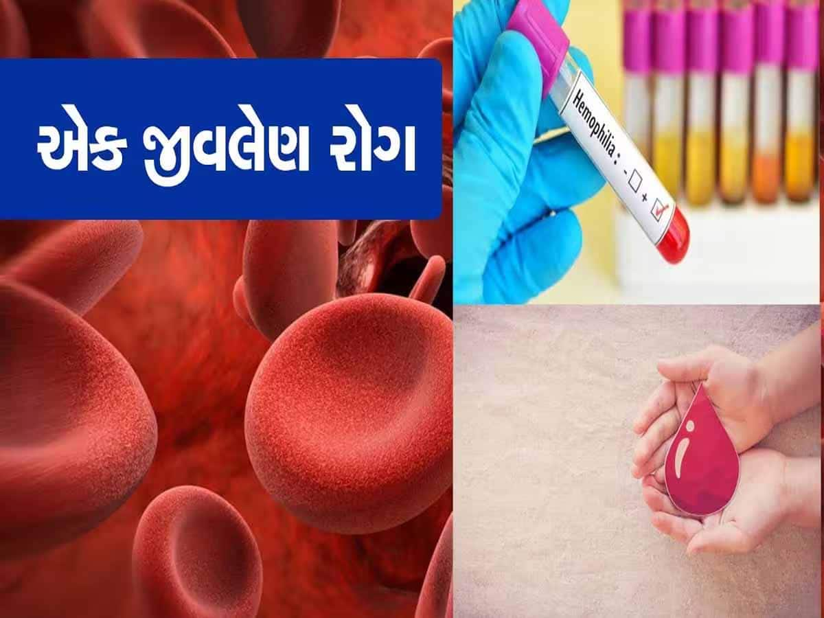  ચાંદીપુરા વાઇરસ વચ્ચે પાદરામાં આ જીવલેણ રોગનો હાહાકાર, 3 કેસ નોંધાતા તંત્રમાં દોડધામ