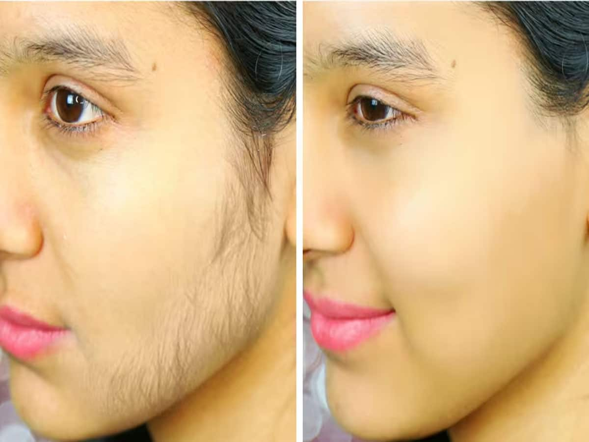 Facial Hair: વેક્સિંગ કે થ્રેડિંગ કરાવ્યા વિના દુર કરવી હોય ચહેરાની રુંવાટી તો ટ્રાય કરો આ ઘરેલુ નુસખા