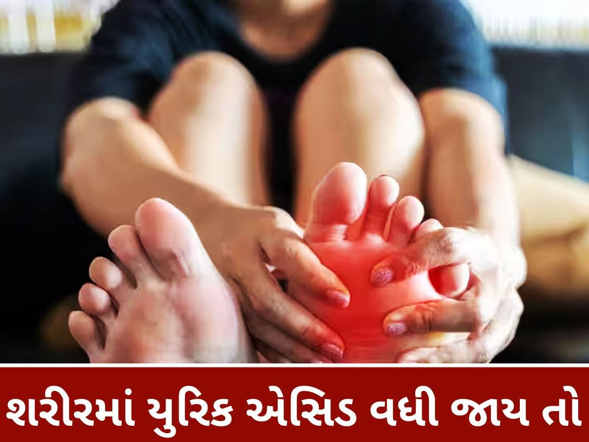 Uric Acid: આ 5 વસ્તુઓથી દૂર થાય છે યુરિક એસિડ, પેશાબ વાટે એસિડ નીકળશે બહાર