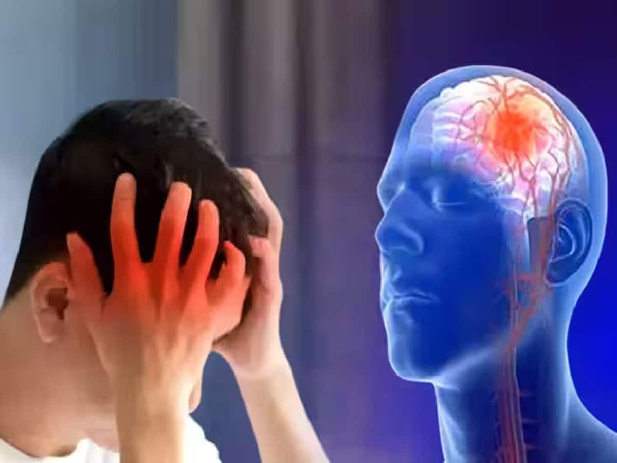 Stroke Symptoms: સ્ટ્રોક આવે તેના 7 દિવસ પહેલા શરીરમાં દેખાય છે આ 5 લક્ષણ, ઈગ્નોર કરવાની ન કરવી ભુલ