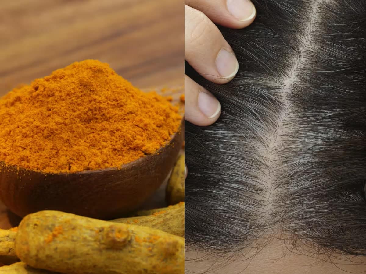 Turmeric For White Hair: 1 અઠવાડિયામાં સફેદ વાળ મૂળમાંથી કાળા થવા લાગશે, ટ્રાય કરો હળદરનું આ હેર માસ્ક