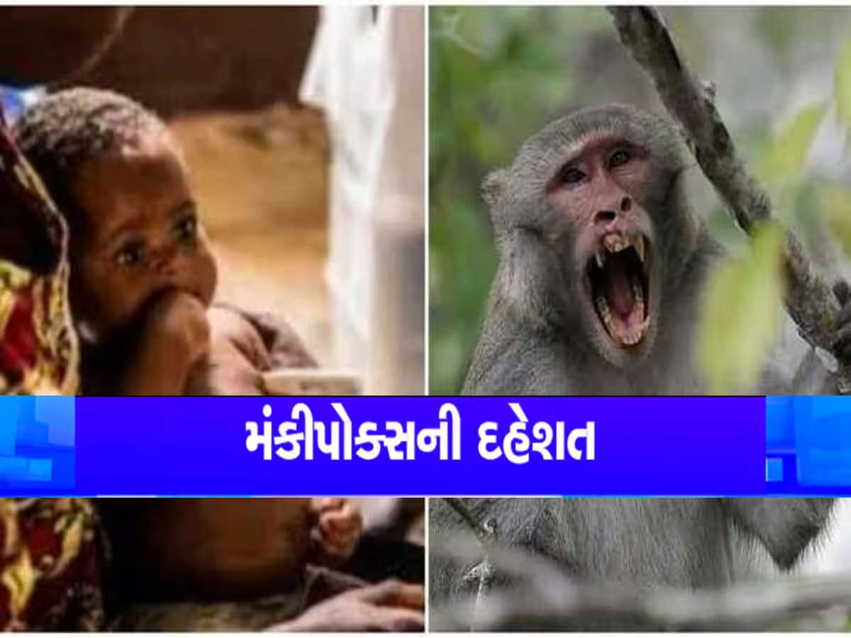 દેશમાં હવે બીજીવાર વેક્સીન લેવાનો વારો આવ્યો, મંકીપોક્સની મહામારીને લઈ આ રાજ્યને અપાયું એલર્ટ 