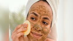 Pimple Home Remedy: 5 રૂપિયામાં મળતી આ 1 વસ્તુ ખીલની સમસ્યાને કાયમ માટે કરશે દુર