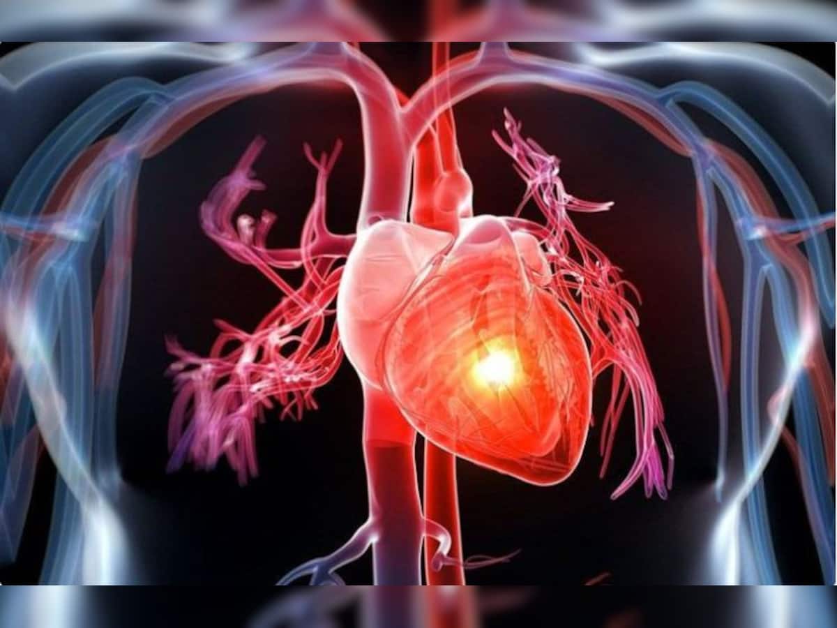 Heart attack risk: હાઈ બ્લડ પ્રેશરની સમસ્યાને ક્યારેય ન કરશો નજરઅંદાજ, આ બની શકે છે હાર્ટ એટેકનું કારણ