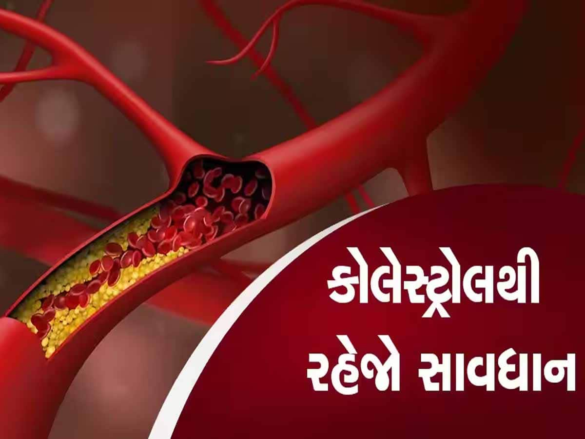 આ ખોરાક શરીરમાં વધારે છે ખરાબ કોલેસ્ટ્રોલ, શિયાળામાં ચાખવાની પણ હિંમત ના કરતા