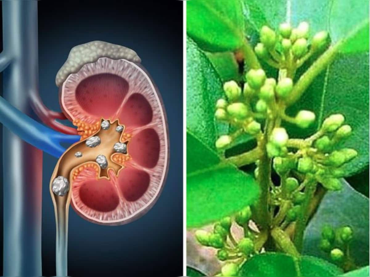 Kidney Blockage: કિડની બ્લોકેજને ખોલવા માટે આયુર્વેદના 3 ચમત્કારી ઉપાય, યૂરિયાનો ખતરો થશે દૂર!