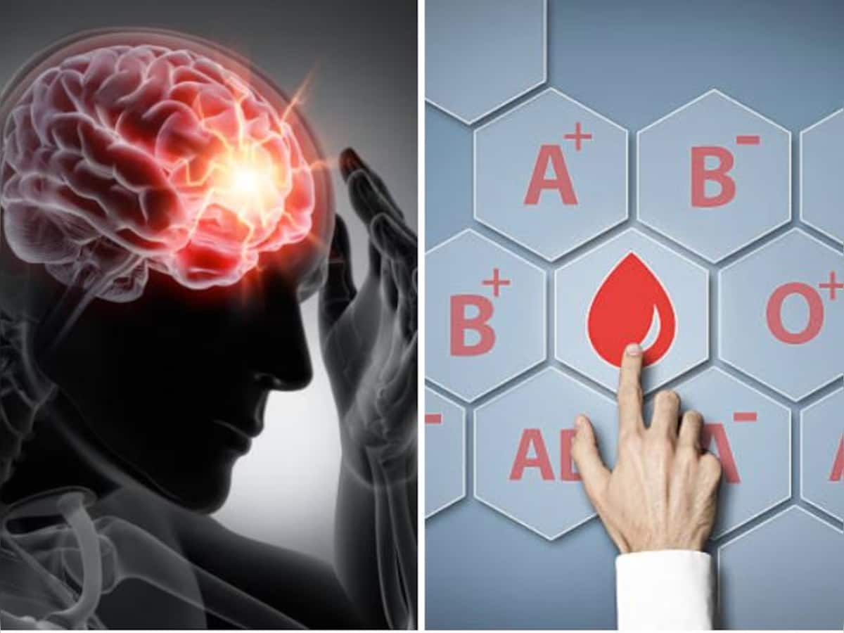 Stroke Risk: આ બ્લડ ગ્રુપના લોકોને વધારે છે સ્ટ્રોકનો ખતરો, સ્ટડીમાં થયો ખૂલાસો