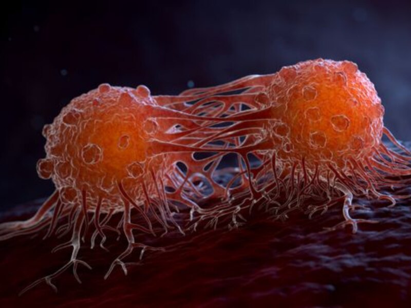 Exercise For Cancer: 50% ઓછું થઈ જશે કેન્સરનું જોખમ, દરરોજ કરો આ 5 કસરતો