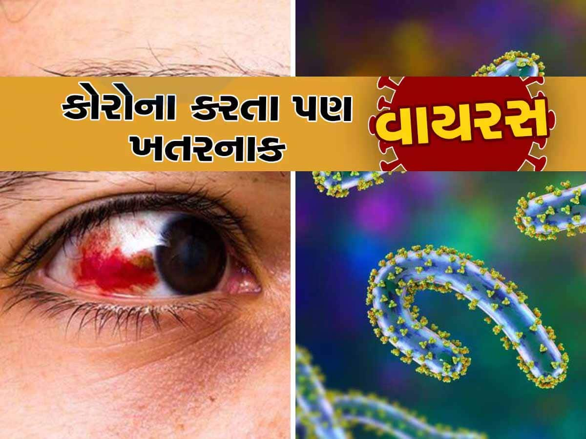 આંખમાંથી નીકળે છે લોહી...! વિદેશ જનારા ફરી સાવધાન! આ 17 દેશોમાં ફેલાયો કોરોના જેવો જીવલેણ રોગ