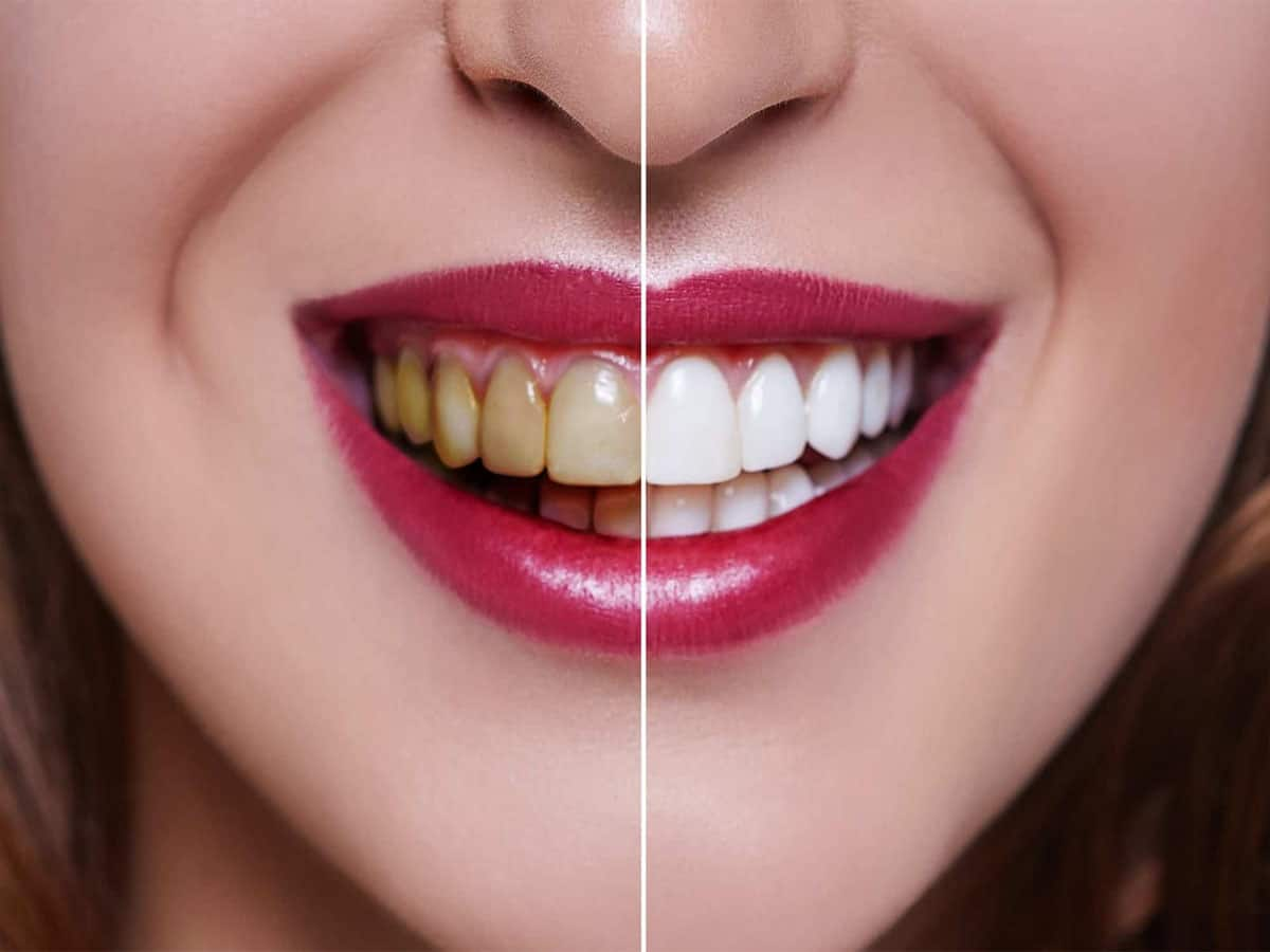 Teeth Whitening Tips: મોતી જેવા સફેદ ચમકતા દાંત માટે અજમાવી જુઓ આ સરળ ઘરેલુ નુસખા