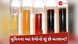 Urine Colour: પીળો, લીલો, ભૂરો અને લાલ, યૂરિનના આ 6 રંગ બતાવશે તમારી સ્વાસ્થ્યનો હાલ