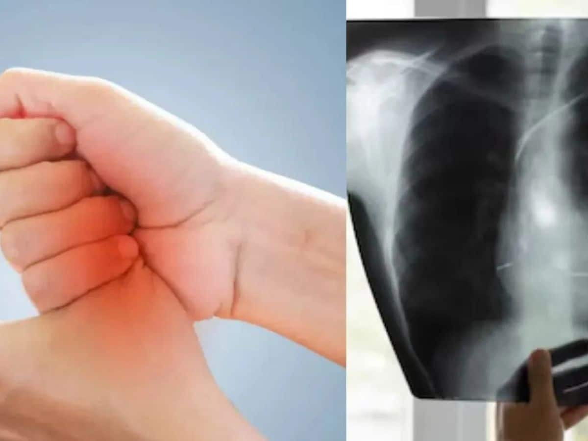 Cancer Symptoms: ફેફસાના કેન્સરના હાથમાં દેખાય છે આ 2 લક્ષણો, જાણો બચવા માટેના ઉપાય