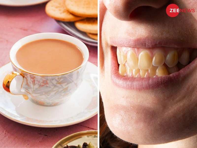 દાંતને પીળા બનાવી Smile છીનવી લે છે આ 5 વસ્તુઓ, તરત છોડો નહીંતર પછતાવવાનો આવશે વારો!