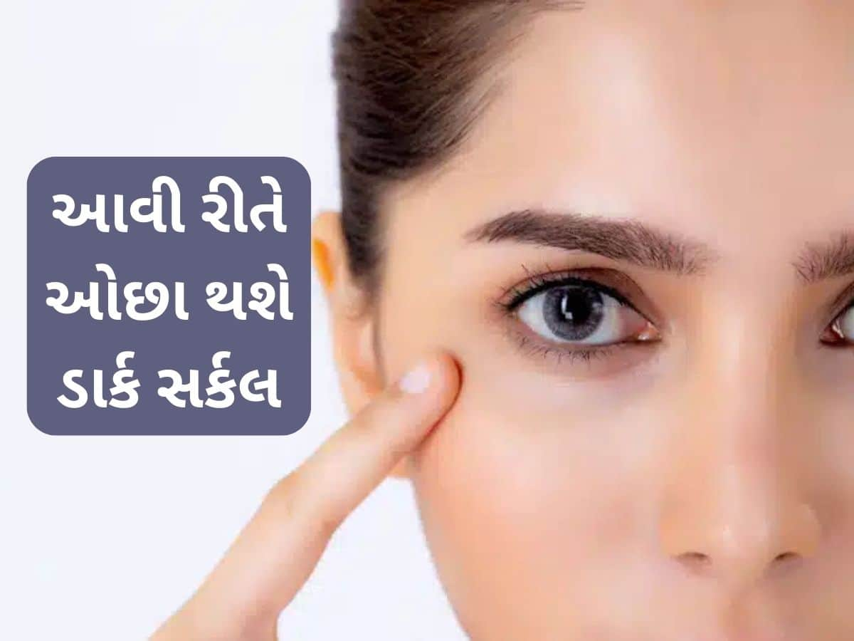 Eye Care Tips: આંખોની નીચે રહેલા કાળા કુંડાળા થશે છૂમંતર, ફોલો કરો બસ આ 7 સરળ ટિપ્સ