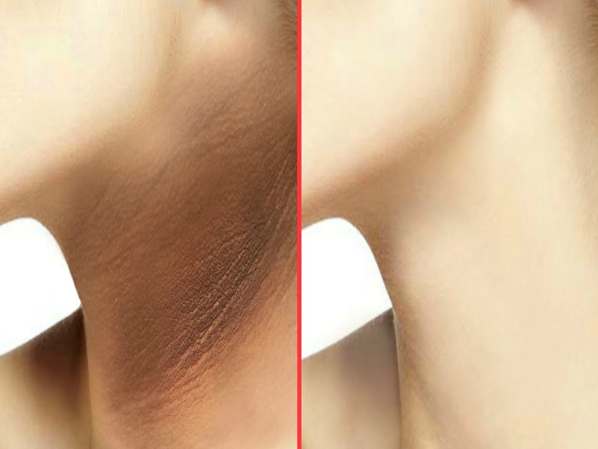 Dark Neck: ગરદનની સ્કિન ચહેરા કરતાં કાળી છે? કોફીમાં આ 2 વસ્તુ મિક્સ કરી લગાડો, ગરદનની કાળી ત્વચા ચહેરા જેવી ગોરી થશે Dark Neck: ગરદનની સ્કિન ચહેરા કરતાં કાળી છે? કોફીમાં આ 2 વસ્તુ મિક્સ કરી લગાડો, ગરદનની કાળી ત્વચા ચહેરા જેવી ગોરી થશે