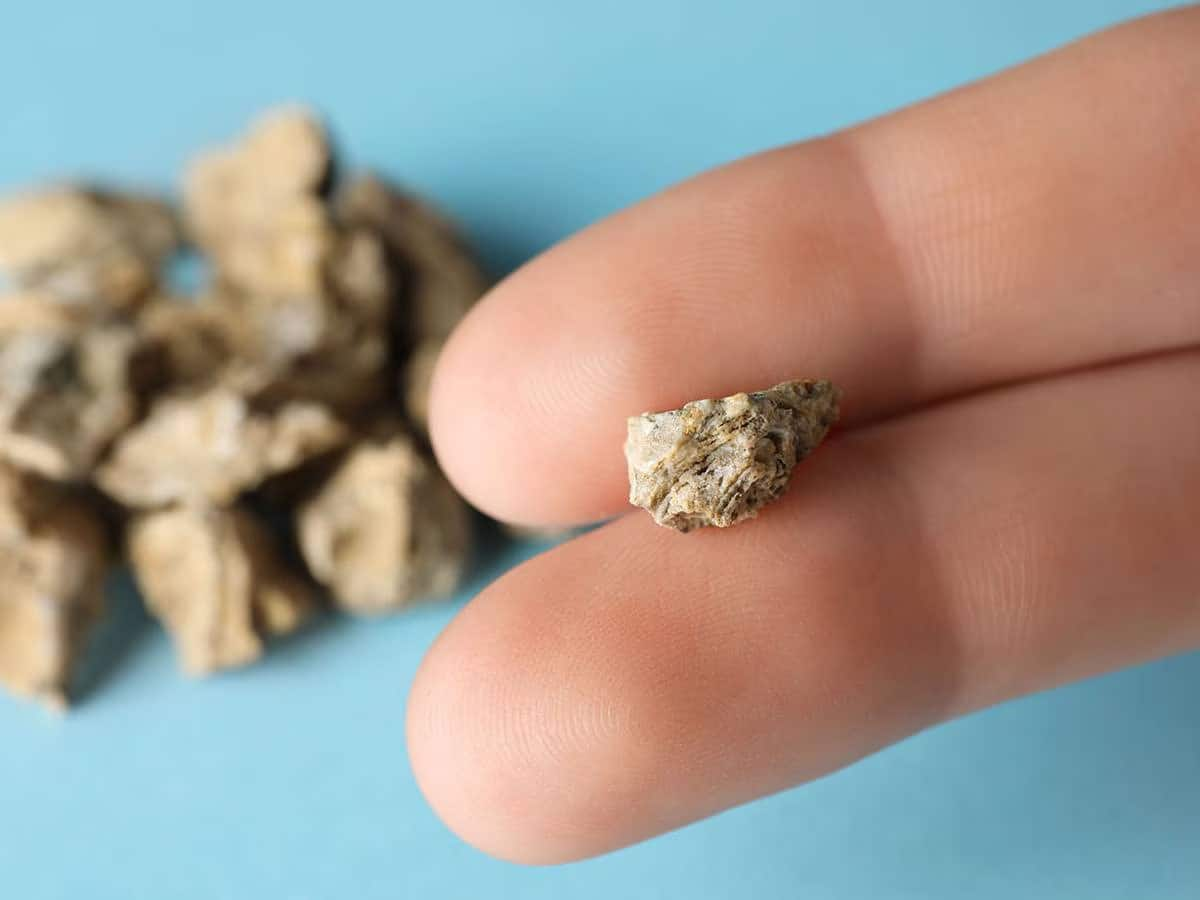 Kidney Stone: પથરીનો સાવ મફત ઈલાજ, ઓપરેશન વિના તુટીને નીકળી જશે પથરી, ખાલી પેટ ખાવું આ લીલું પાન