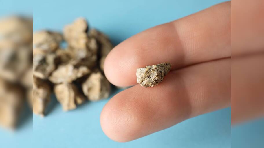 Kidney Stone: પથરીનો સાવ મફત ઈલાજ, ઓપરેશન વિના તુટીને નીકળી જશે પથરી, ખાલી પેટ ખાવું આ લીલું પાન