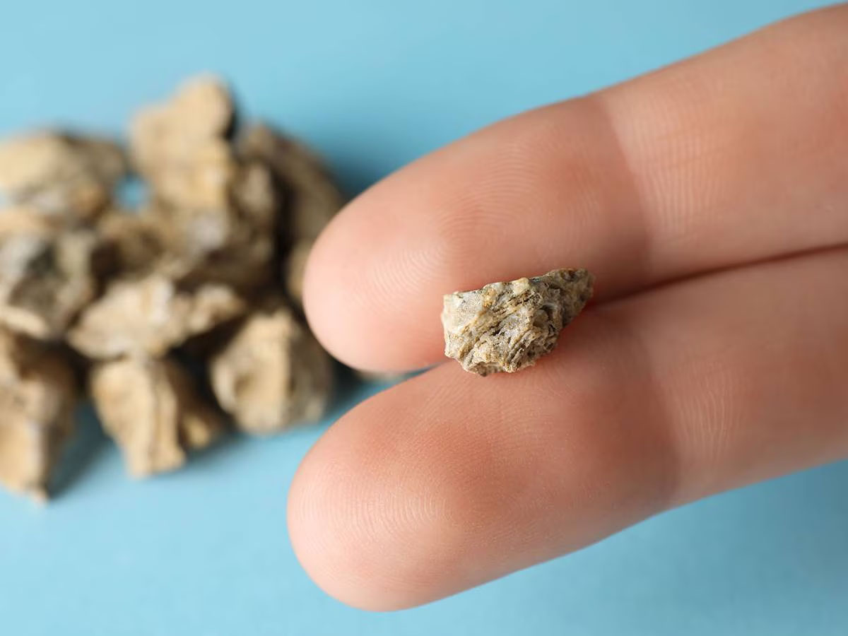 Kidney Stone: પથરીનો સાવ મફત ઈલાજ, ઓપરેશન વિના તુટીને નીકળી જશે પથરી, ખાલી પેટ ખાવું આ લીલું પાન Kidney Stone: પથરીનો સાવ મફત ઈલાજ, ઓપરેશન વિના તુટીને નીકળી જશે પથરી, ખાલી પેટ ખાવું આ લીલું પાન
