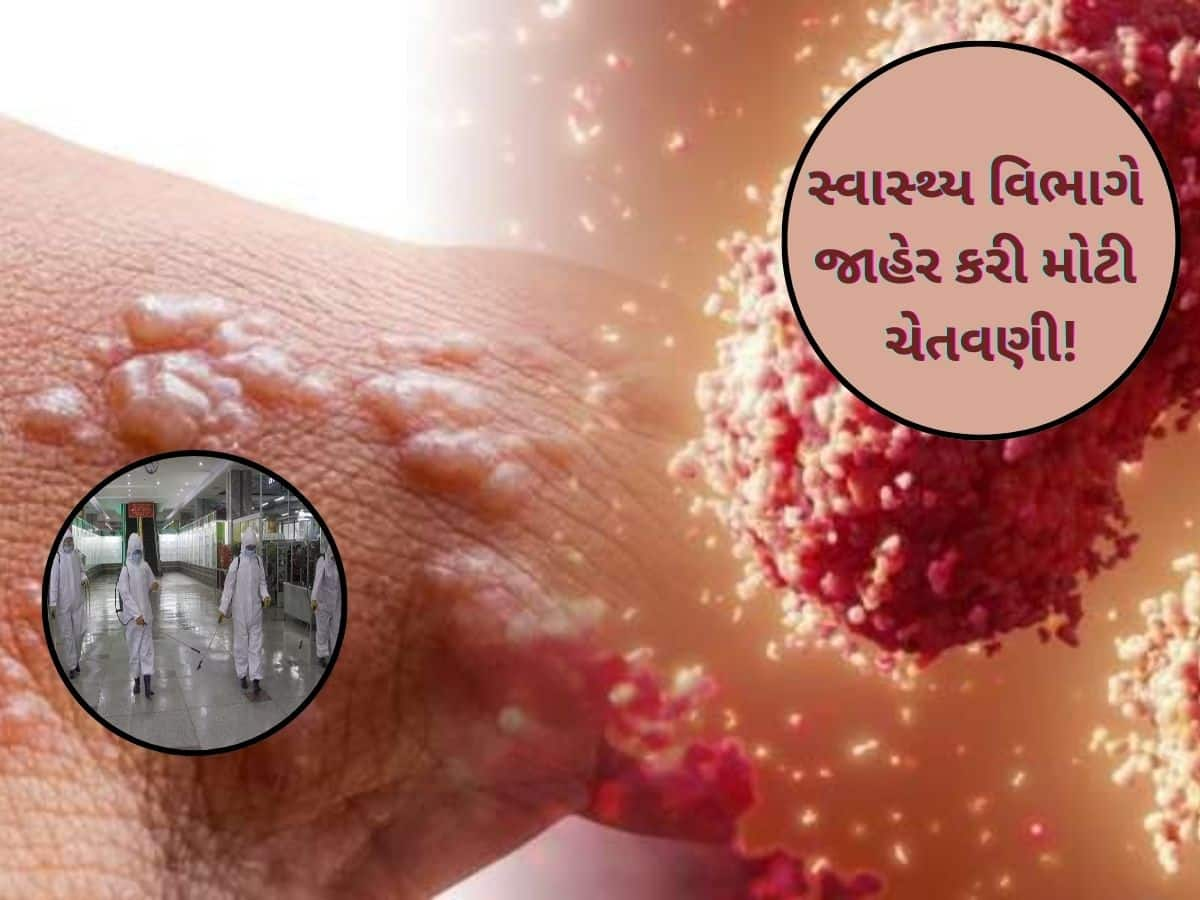 સાવધાન! HMPV બાદ ભારતમાં હવે આ જીવલેણ વાયરસની એન્ટ્રી, દેશમાં પહેલો કેસ, આ લોકોને છે ખતરો