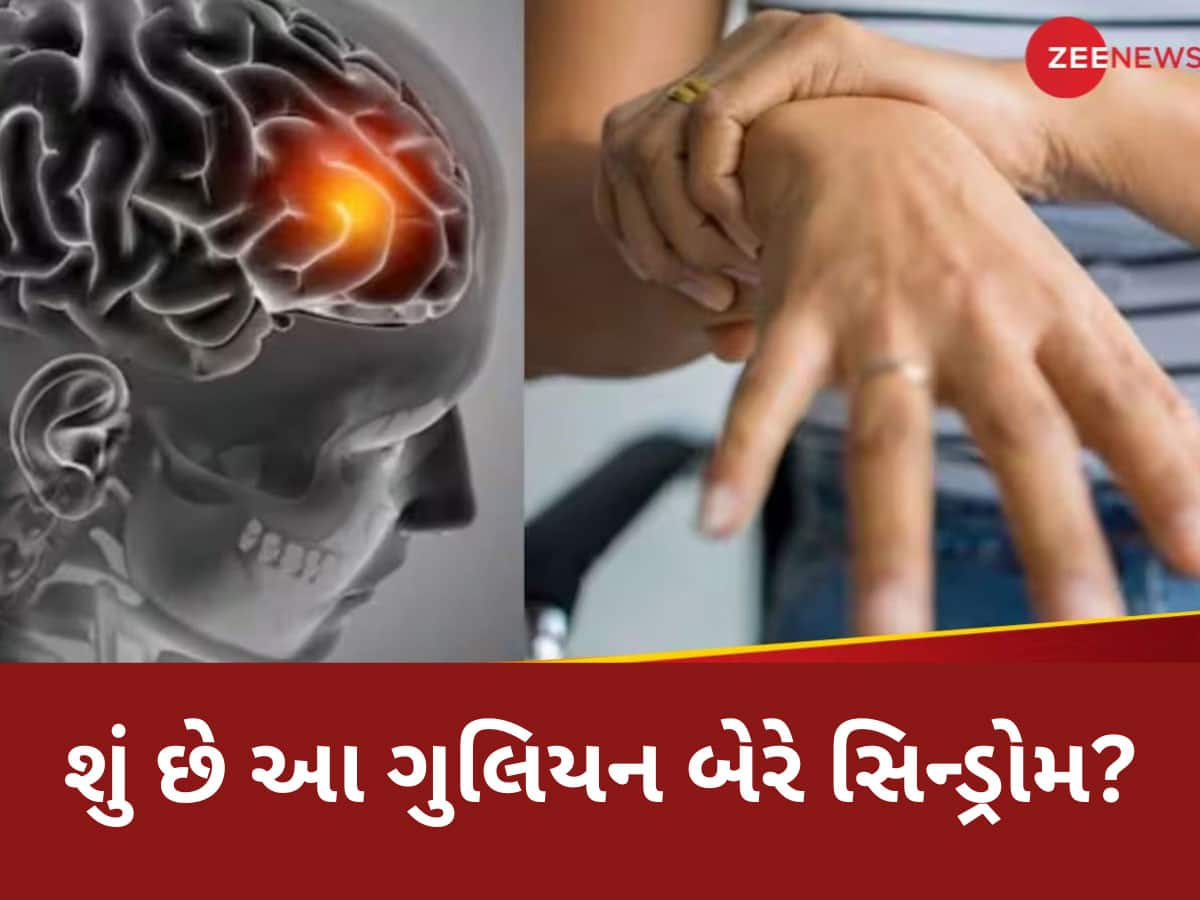 ગુજરાતના પાડોશમાં ગુલિયન બેરે સિન્ડ્રોમનો હાહાકાર, 16 દર્દી વેન્ટિલેટર પર, પહેલું મોત નોંધાયું