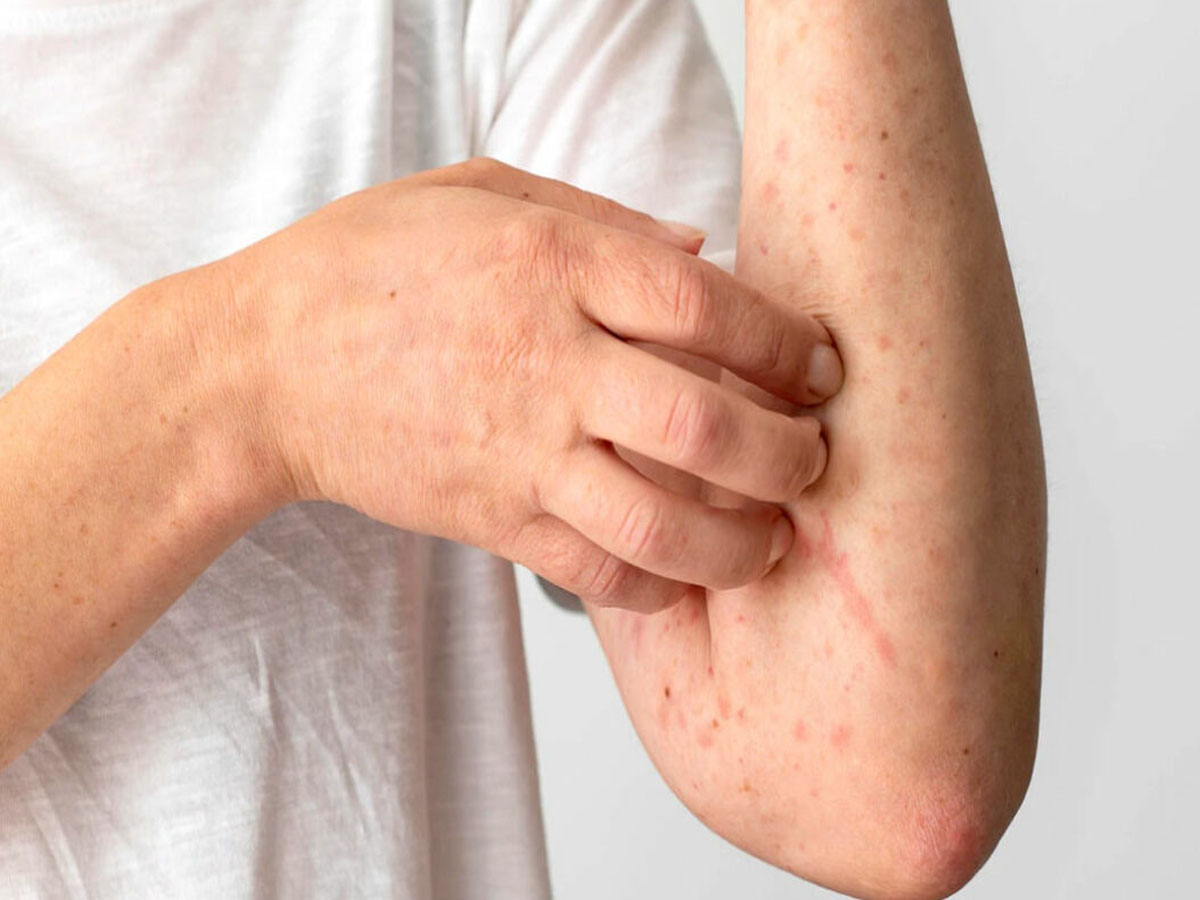 Liver Damage Signs: લીવર ડેમેજ થતું હોય ત્યારે શરીરમાં જોવા મળે છે આ 5 લક્ષણો, જાણો બચવાના ઉપાય