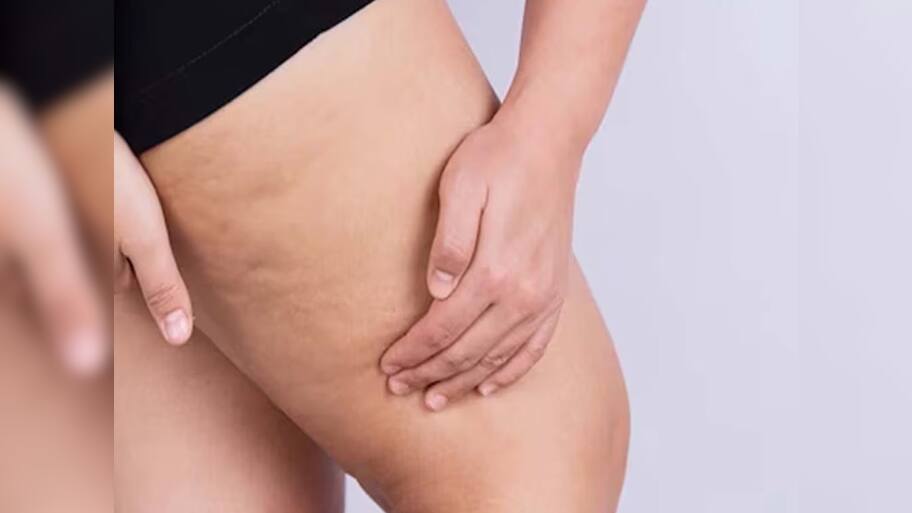 Lower Body Fat: કમર, સાથળ, જાંઘ પર જામેલી ચરબી ઉતારવાનો સૌથી અસરકારક દેશી ઉપાય, ગણતરીના દિવસોમાં ઘટી જશે કમરનો ઘેરાવો