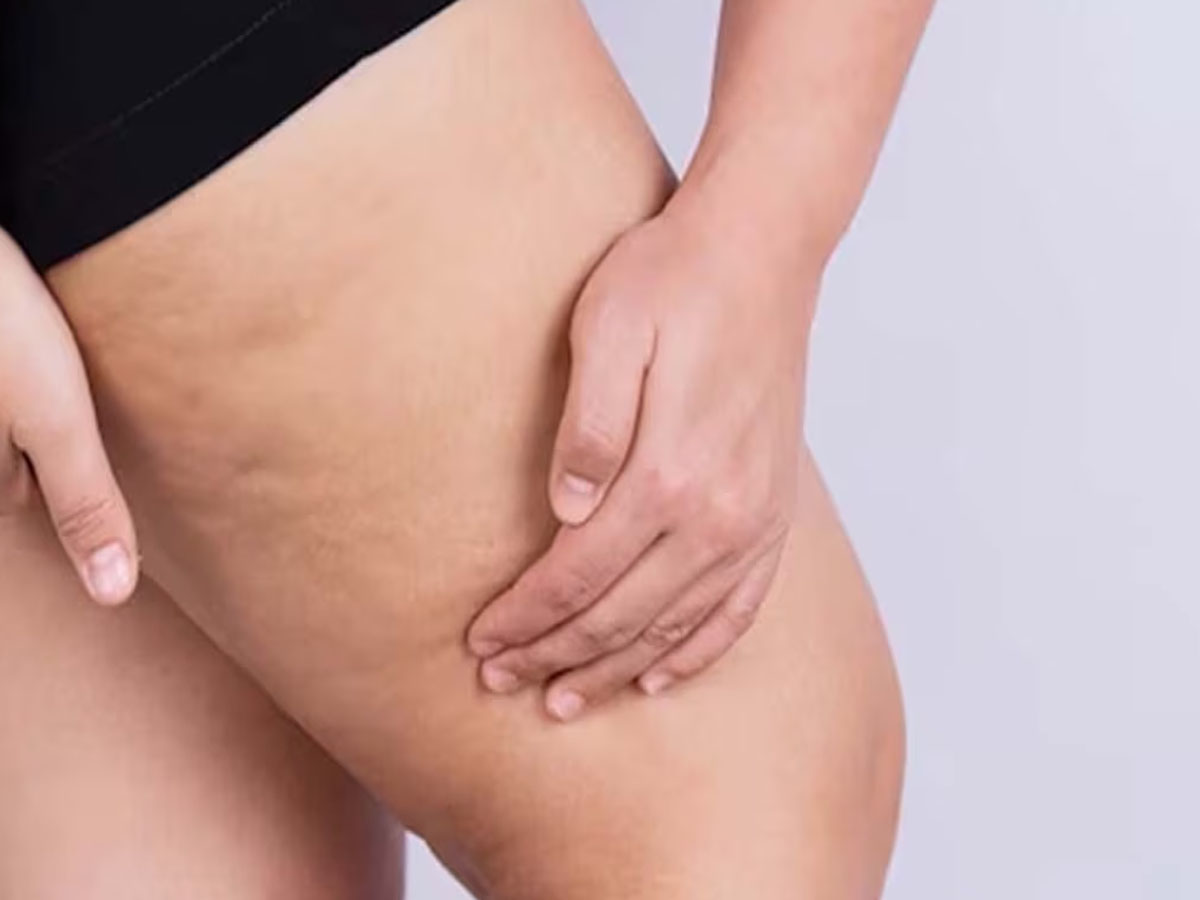Lower Body Fat: કમર, સાથળ, જાંઘ પર જામેલી ચરબી ઉતારવાનો સૌથી અસરકારક દેશી ઉપાય, ગણતરીના દિવસોમાં ઘટી જશે કમરનો ઘેરાવો Lower Body Fat: કમર, સાથળ, જાંઘ પર જામેલી ચરબી ઉતારવાનો સૌથી અસરકારક દેશી ઉપાય, ગણતરીના દિવસોમાં ઘટી જશે કમરનો ઘેરાવો