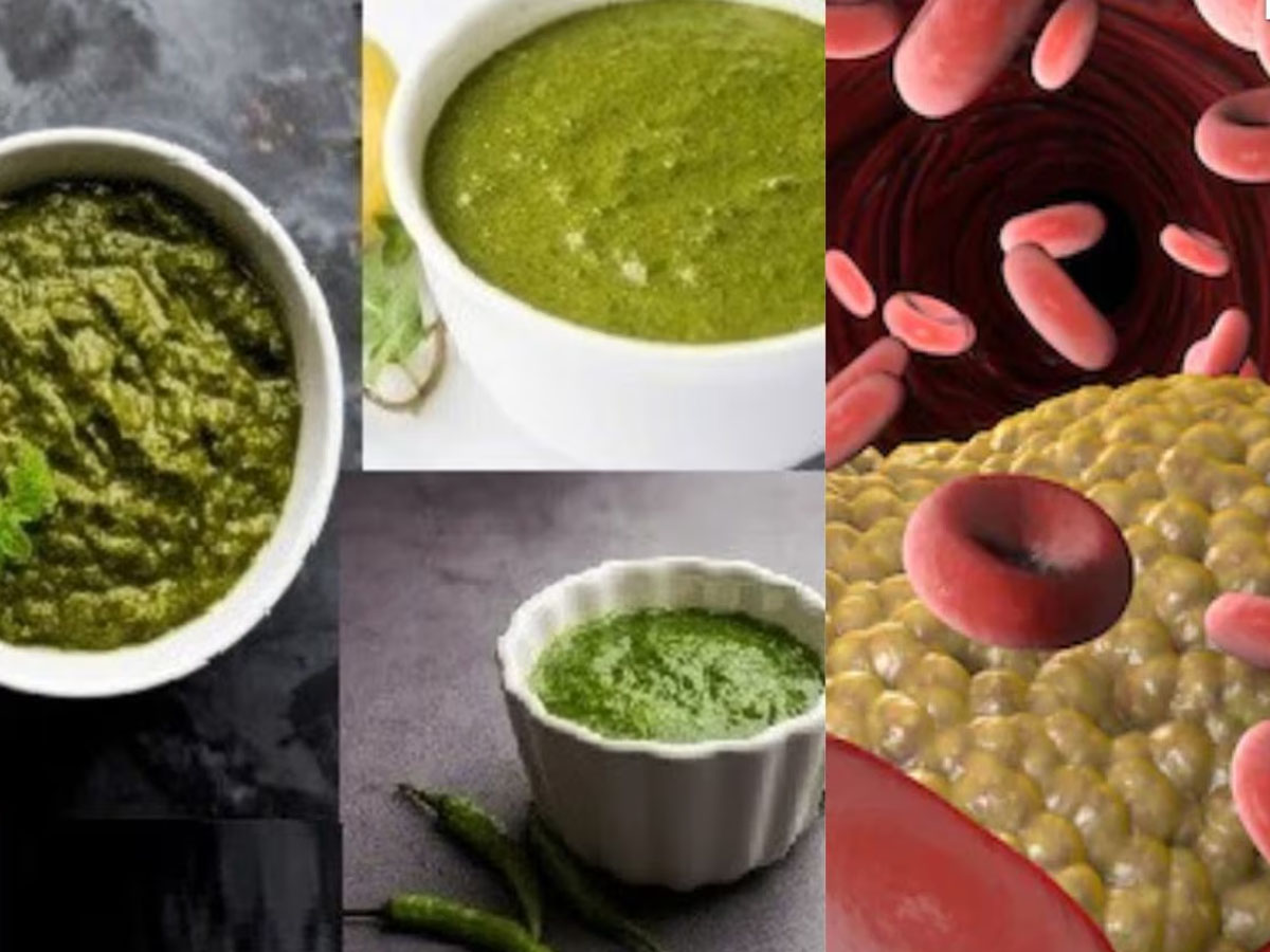 Bad Cholesterol: નસોમાં જામેલા બેડ કોલેસ્ટ્રોલને સાફ કરી નાખશે આ 3 પ્રકારની ચટણી, ખાવાથી હાર્ટ રહેશે હેલ્ધી Bad Cholesterol: નસોમાં જામેલા બેડ કોલેસ્ટ્રોલને સાફ કરી નાખશે આ 3 પ્રકારની ચટણી, ખાવાથી હાર્ટ રહેશે હેલ્ધી
