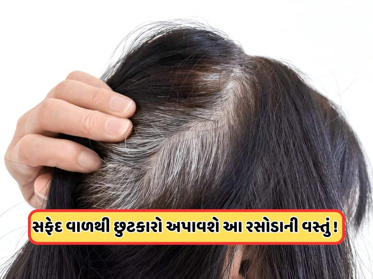 White Hair Home Remedies:  નાની ઉંમરે વાળ થઈ ગયા છે સફેદ, તો આ રસોડાની વસ્તુઓ લગાવવાનું કરો શરૂ, વાળ થઈ જશે કાળા