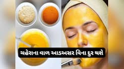 Haldi: આ વસ્તુમાં હળદર મિક્સ કરી લગાડો સ્કિન પર, ચહેરા પરના વાળથી મળી જશે છુટકારો