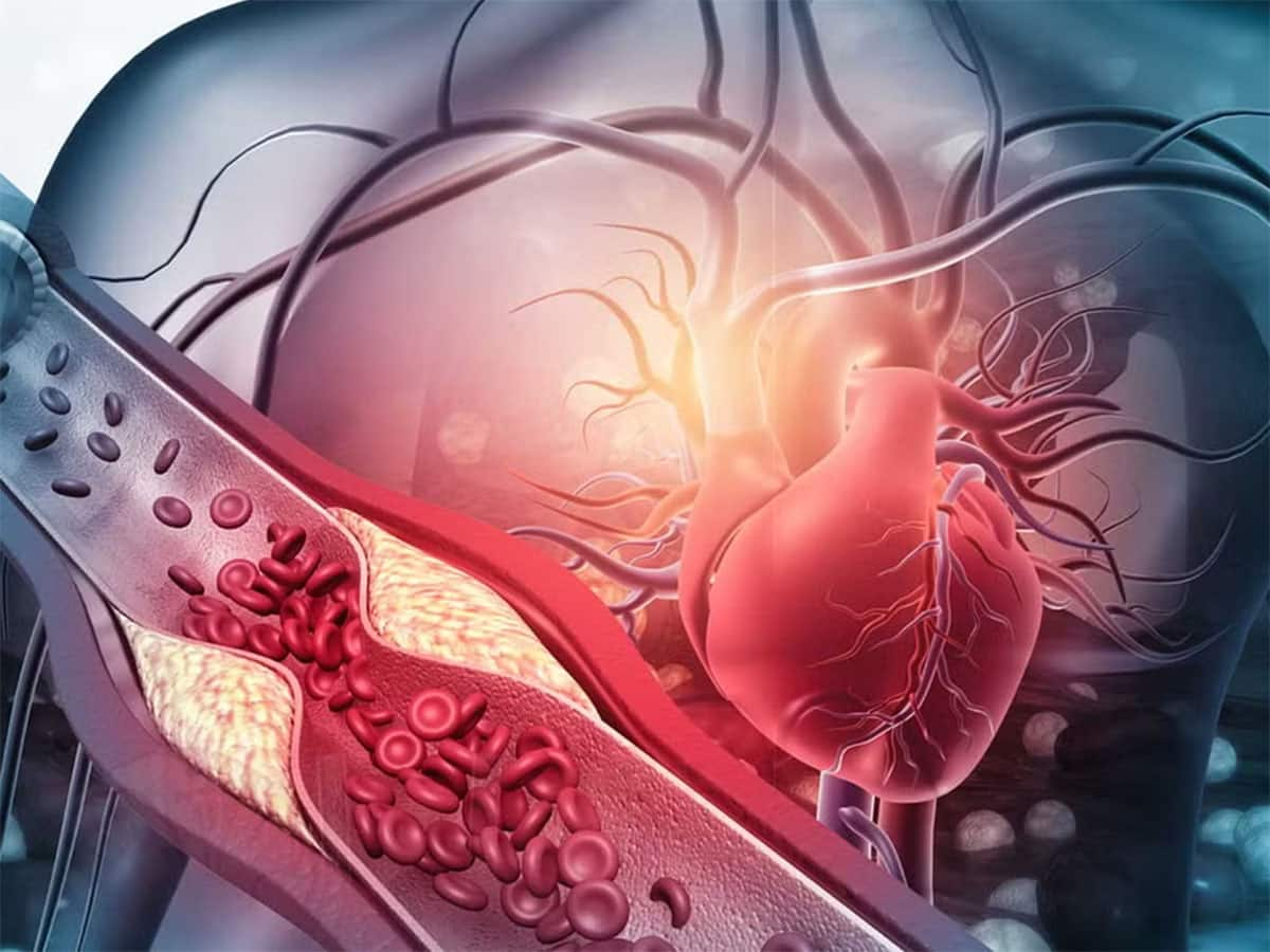 Heart Blockage Signs: ધમનીઓ બ્લોક હોય ત્યારે શરીરમાં દેખાય આ લક્ષણો, 5 માંથી 1 ને પણ ઈગ્નોર ન કરતાં