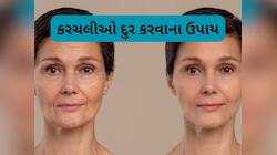 Skin Care: ઢીલી પડેલી સ્કિન પણ ટાઈટ થશે, લીંબુના રસમાં આ વસ્તુ ઉમેરી લગાડો સ્કિન પર