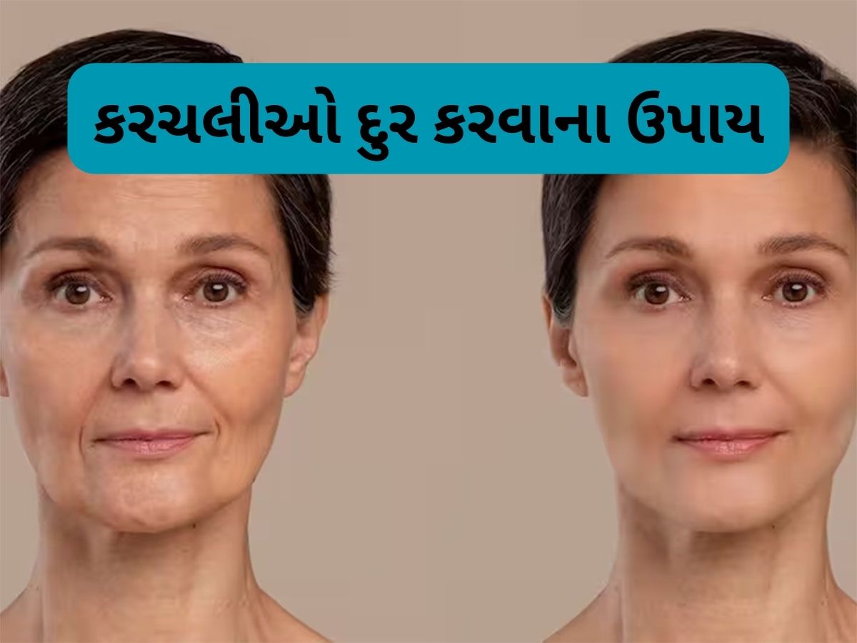 Skin Care: ઢીલી પડેલી સ્કિન પણ ટાઈટ થઈ જશે, લીંબુના રસમાં આ વસ્તુ ઉમેરી લગાડો સ્કિન પર Skin Care: ઢીલી પડેલી સ્કિન પણ ટાઈટ થઈ જશે, લીંબુના રસમાં આ વસ્તુ ઉમેરી લગાડો સ્કિન પર