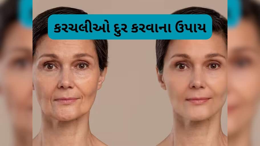 Skin Care: ઢીલી પડેલી સ્કિન પણ ટાઈટ થઈ જશે, લીંબુના રસમાં આ વસ્તુ ઉમેરી લગાડો સ્કિન પર
