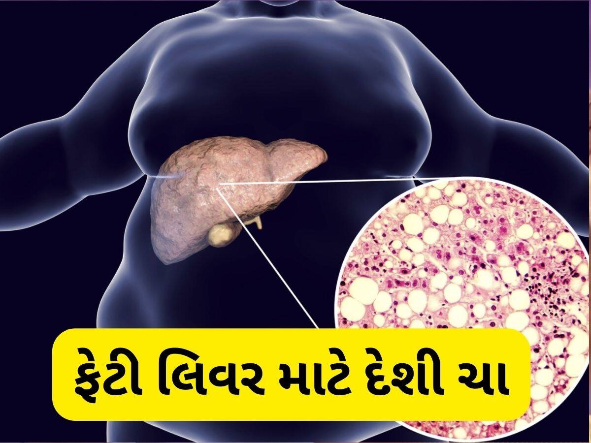  ફેટી લિવરના દર્દી સવારે 1 કપ પીવે આ ચા, મહિનામાં જોવા મળશે અસર, Liver થઈ જશે Healthy