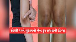 Dark Elbow-Knee: કોણી અને ઘુંટણની કાળી સ્કિન ગોરી થઈ જશે, આ રીતે રોજ લગાડો ચણાનો લોટ