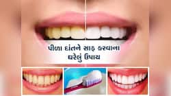 દાંતની સફાઈ કરવા માટે આ ફળની છાલનો કરો ઉપયોગ, મોતીની જેમ ચમકી જશે તમારા દાંત