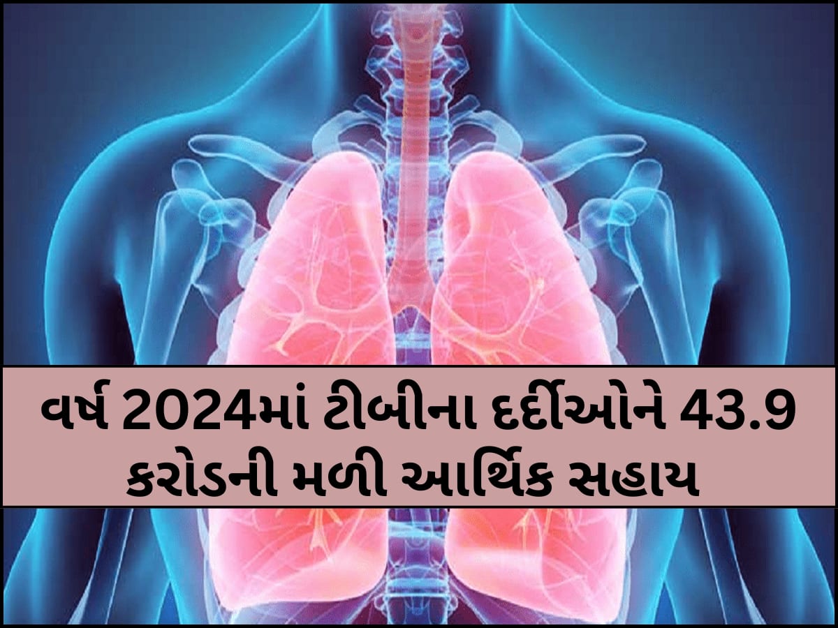 100 દિવસીય સઘન ટીબી નાબૂદી અભિયાનમાં ગુજરાત અગ્રેસર, 95% લક્ષ્યાંક કર્યો હાંસલ