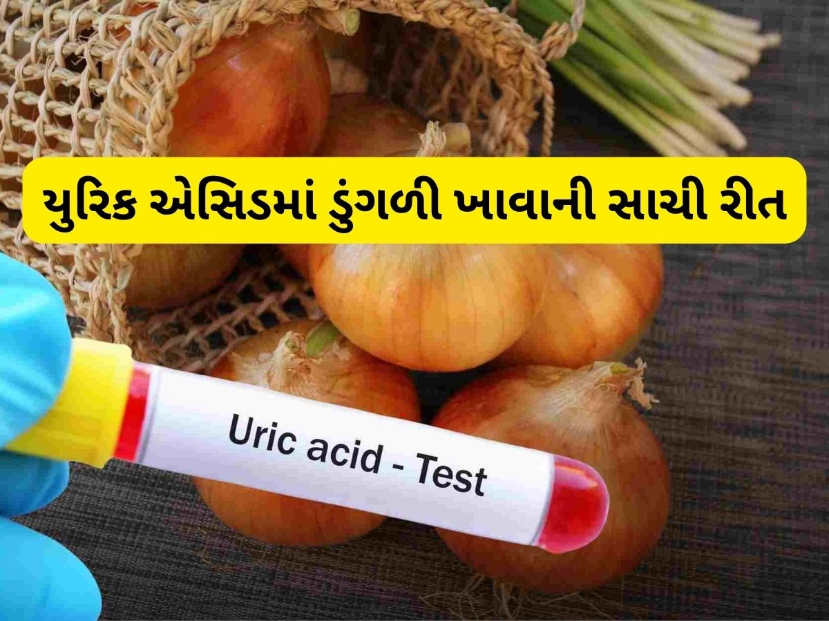 યુરિક એસિડ માટે રામબાણ છે ડુંગળી, બસ આ રીતે કરો સેવન યુરિક એસિડ માટે રામબાણ છે ડુંગળી, બસ આ રીતે કરો સેવન