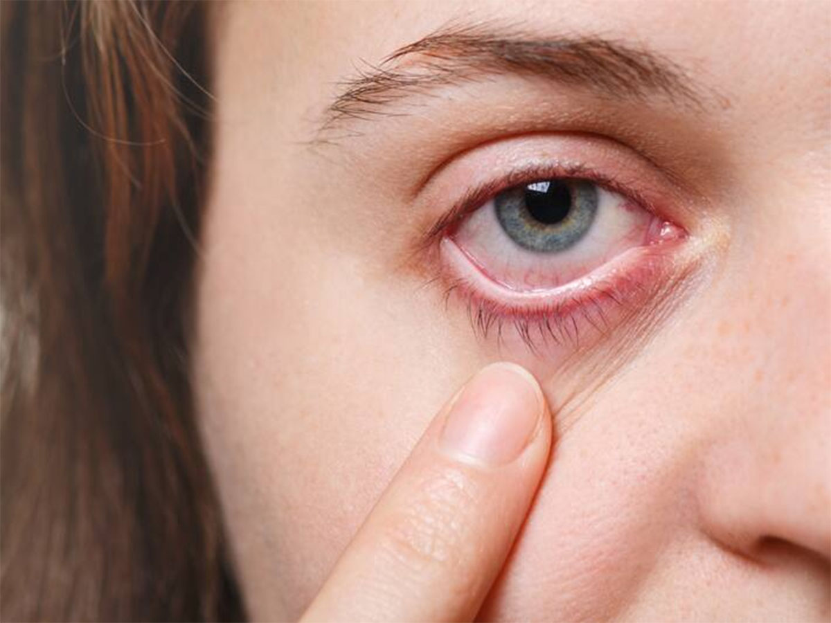 Dry Eye Syndrome: કલાકો સુધી રીલ્સ જોવાની આદત આંખ માટે મોટું જોખમ, તાત્કાલીક વાંચો આ ચેતવણી Dry Eye Syndrome: કલાકો સુધી રીલ્સ જોવાની આદત આંખ માટે મોટું જોખમ, તાત્કાલીક વાંચો આ ચેતવણી