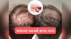 ડુંગળીના રસ સાથે આ વસ્તુ ત્યાં લગાડો જ્યાંથી વાળ ખરી ગયા હોય, કાળા વાળ ઉગવા લાગશે