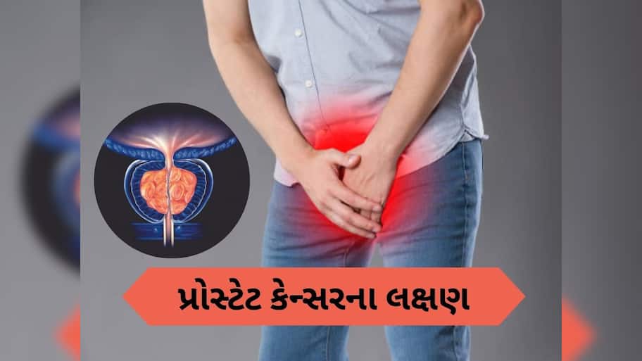 29 લાખ પુરૂષો 2040 સુધી થઈ શકે છે પ્રાઇવેટ પાર્ટના કેન્સરનો શિકાર, રિપોર્ટમાં દાવો, આ લક્ષણોને હળવાશથી ન લો