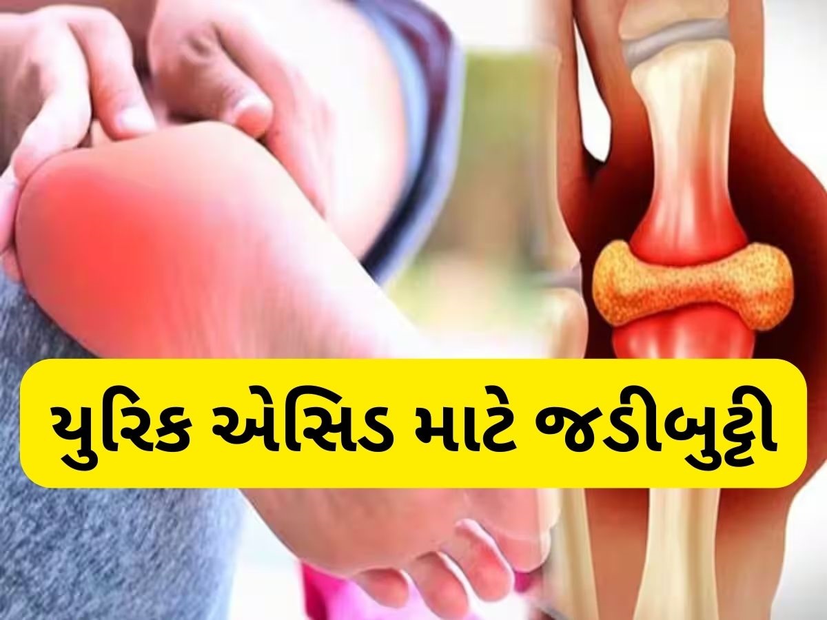 યુરિક એસિડનો ખાત્મો કરશે આ દેશી જડીબુટ્ટી, સાંધાના દુખાવાથી રાહત મેળવવા આ રીતે સેવન કરો યુરિક એસિડનો ખાત્મો કરશે આ દેશી જડીબુટ્ટી, સાંધાના દુખાવાથી રાહત મેળવવા આ રીતે સેવન કરો