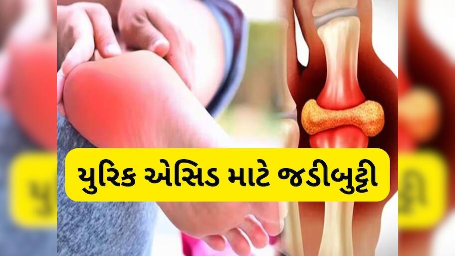 યુરિક એસિડનો ખાત્મો કરશે આ દેશી જડીબુટ્ટી, સાંધાના દુખાવાથી રાહત મેળવવા આ રીતે સેવન કરો