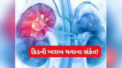 કિડની ખરાબ થાય તો ચામડી પર જોવા મળે આ 4 લક્ષણ, ઘરગથ્થું ઉપાય છોડી ડોક્ટર પાસે દોડો