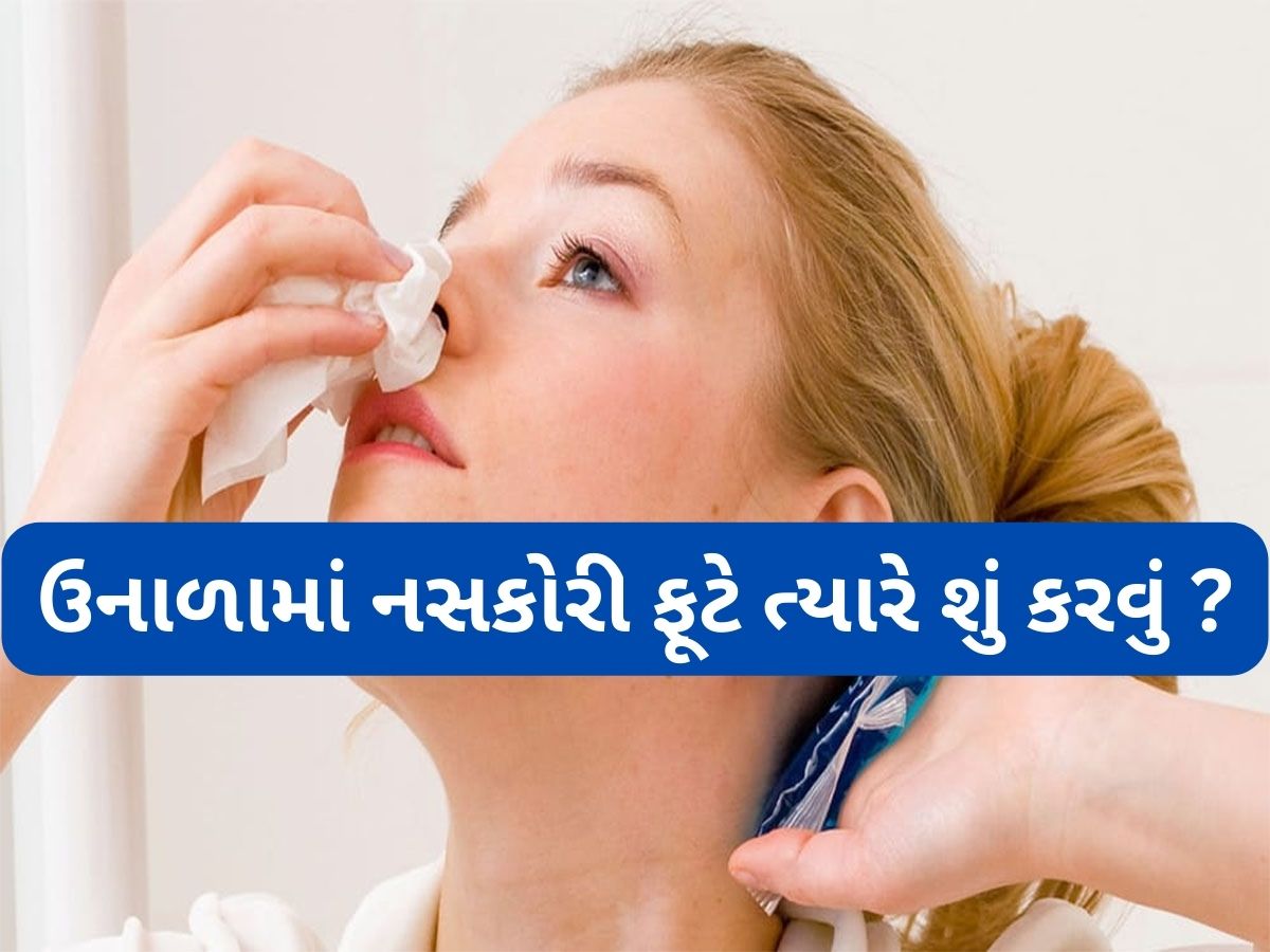 Nose Bleeding: નસકોરી ફુટે કે તુરંત આ કામ કરો તો 30 જ સેકન્ડમાં નાકમાંથી લોહી નીકળતું બંધ થઈ જાશે