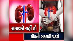 ઉનાળામાં તમારી આ 4 આદતો કરી શકે છે કિડનીને ડેમેજ, કરી લો આ બદલાવ નહીં તો થશે પછતાવો!